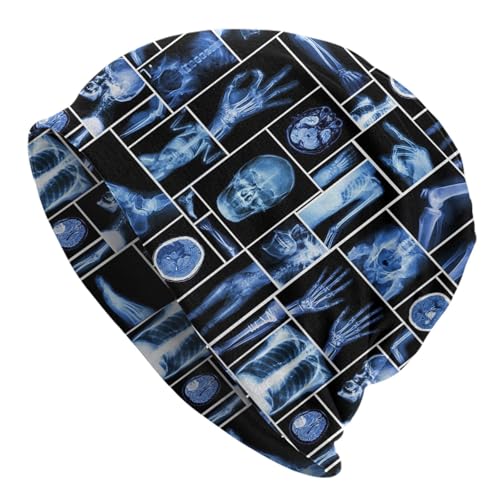 Beanie Hat for Men Women Slouchy Beanie Skull Sleep Cap Soft Lightweight Chemo Hat Stretch Cancer Headwear - color: X-rays